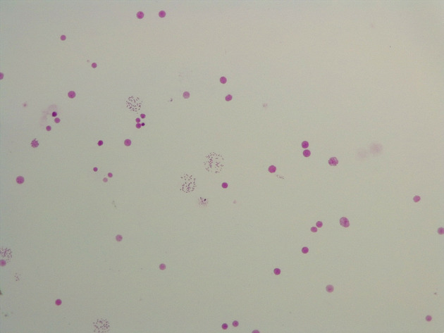 Female Chromosomes Slides - Female Chromosomes 03 100X